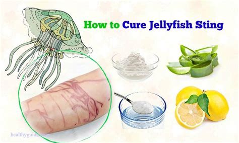 16 Tips How To Cure Jellyfish Sting Rash Itching Naturally After A Week