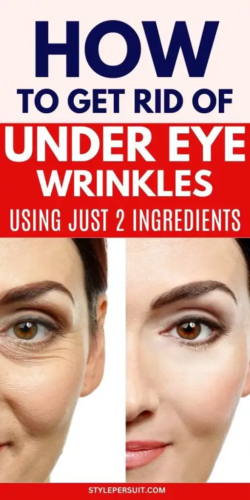 20 Best Under Eye Wrinkles Remedies Artofit