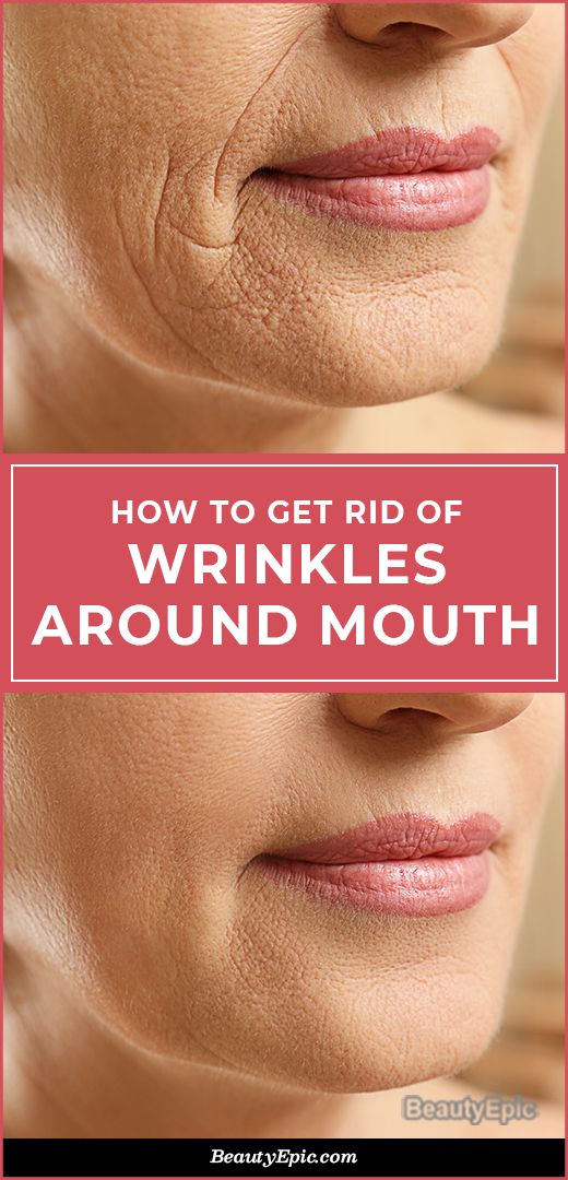 5 Ways To Get Rid Of Wrinkles And Fine Lines Around Your Eyes My