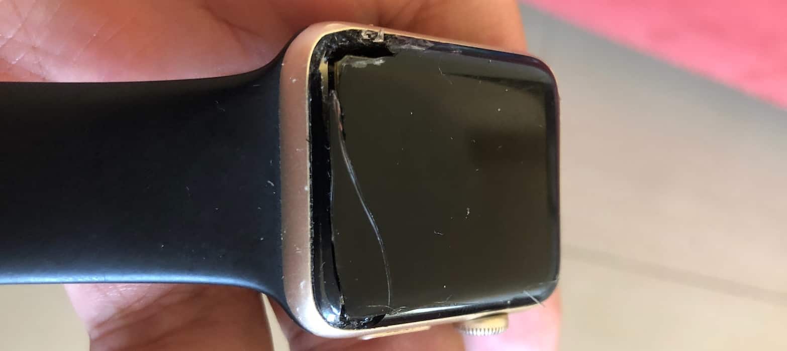 Here S Why Your Apple Watch Is Leaving Burn Marks On Your Wrist The