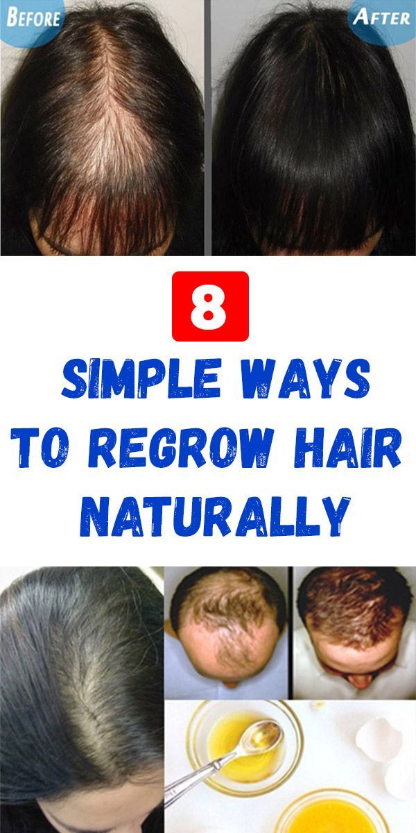 How To Grow Long And Thicken Hair Naturally And Faster 100% Work (Hair ...