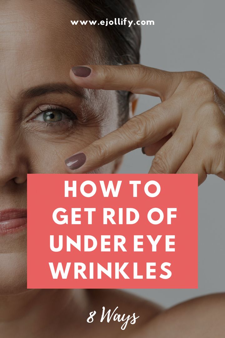 How To Remove Wrinkles Under The Eyes Naturally 2018 Youtube