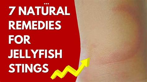 Jellyfish Sting Rash Pictures: The Essential Guide To Identification