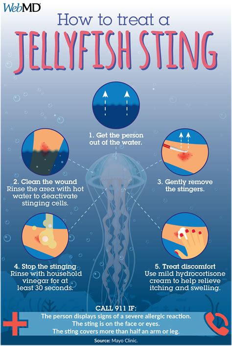 Jellyfish Sting Symptoms How To Treat A Jellyfish Sting