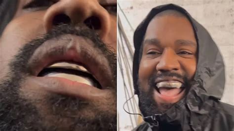 Kanye West Shows Off 850K Titanium Teeth As He Says He S From Mars In