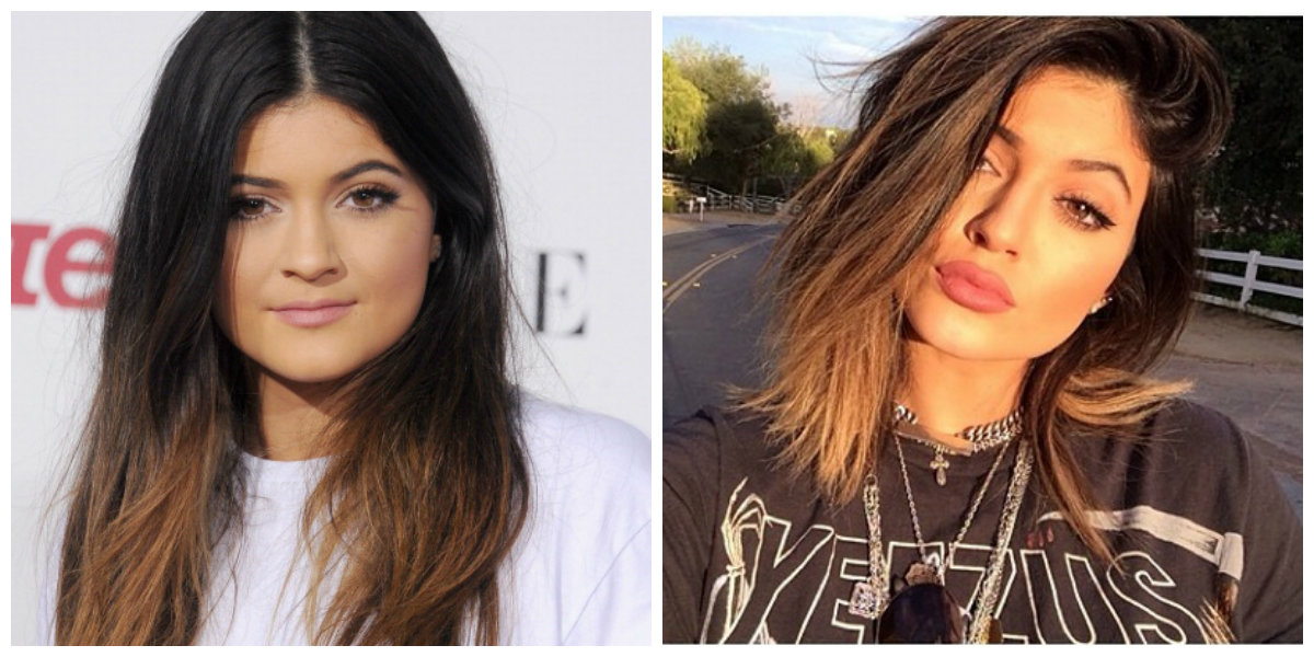 Kylie Jenner Plastic Surgery